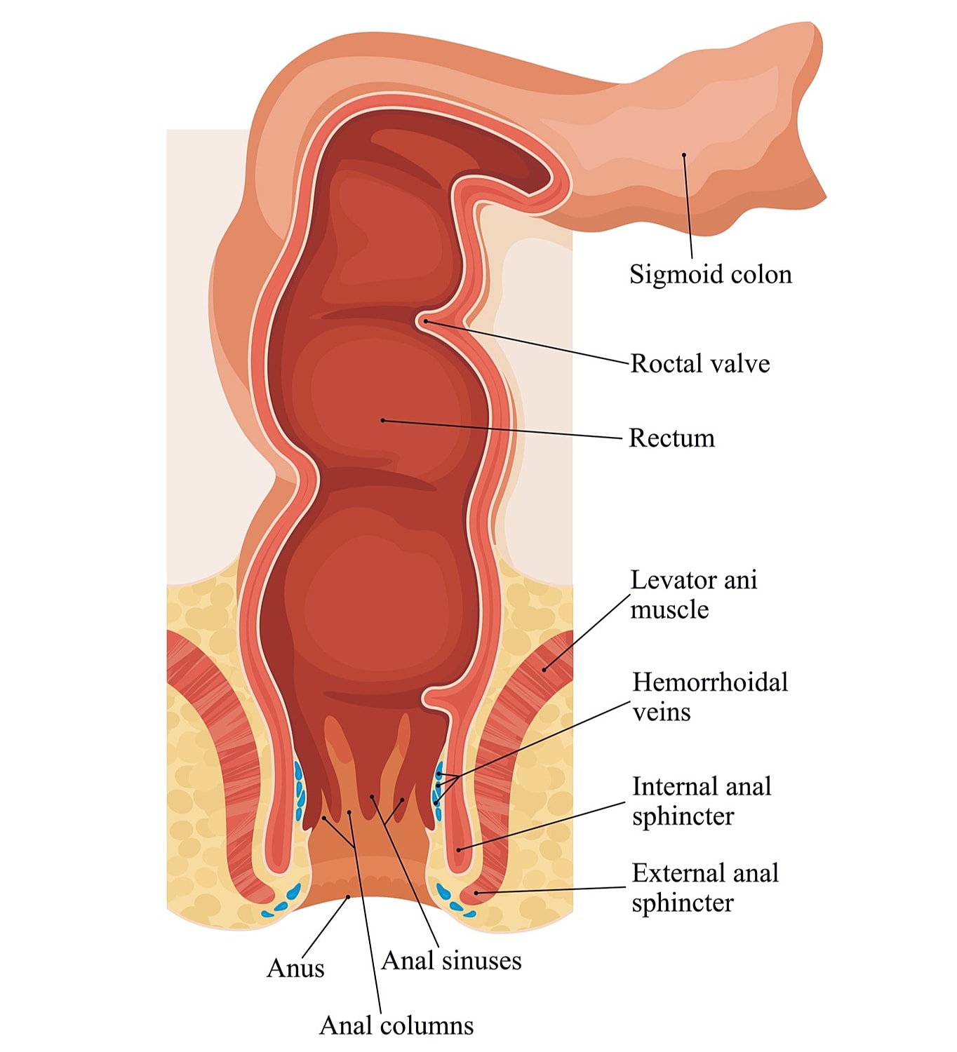 Anal Botox for Fissures and Tight Sphincters